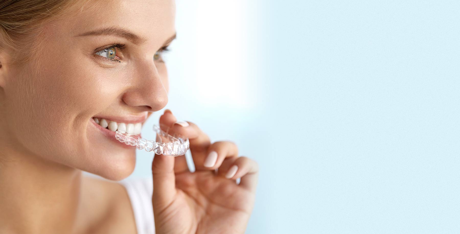 Clear Aligners Discount