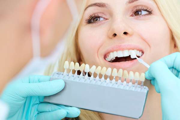 How a Cosmetic Dentist Places Dental Veneers from Fashion Isle Smiles in Newport Beach, CA