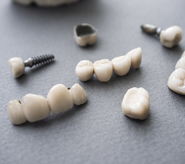 Newport Beach The Difference Between Dental Implants and Mini Dental Implants
